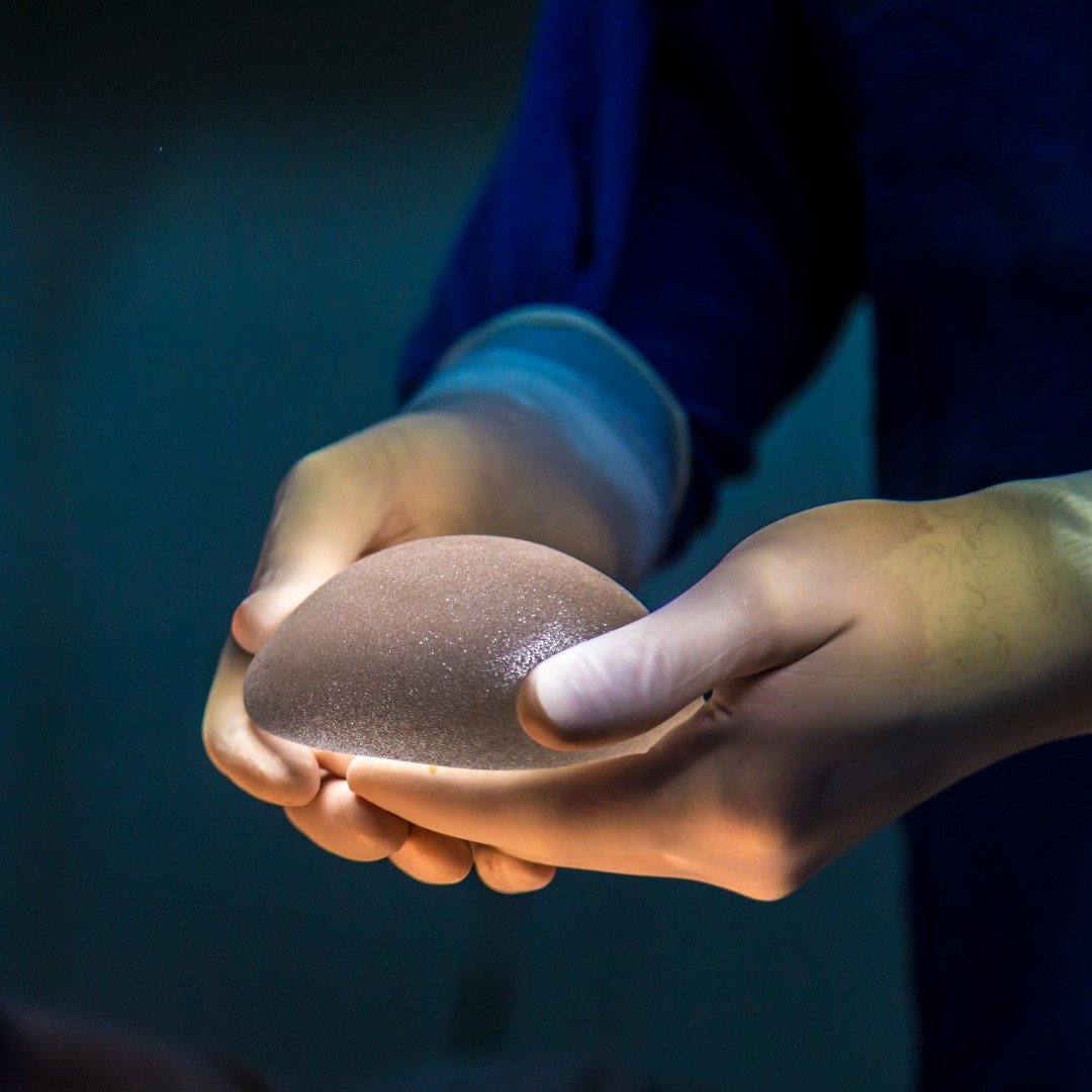 Preguntas frecuentes sobre el aumento de pecho con implantes